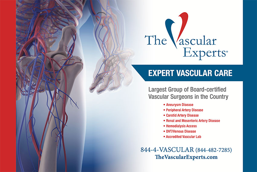 The Vascular Experts Trade Show Display